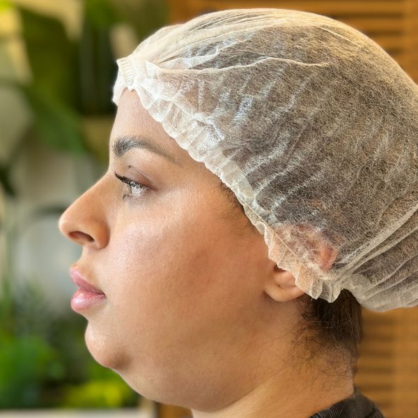 Before treatment - Patient 1